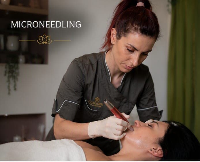 Microneedling Craiova – tratament profesional Procedură Microneedling la Claire Beauty Craiova